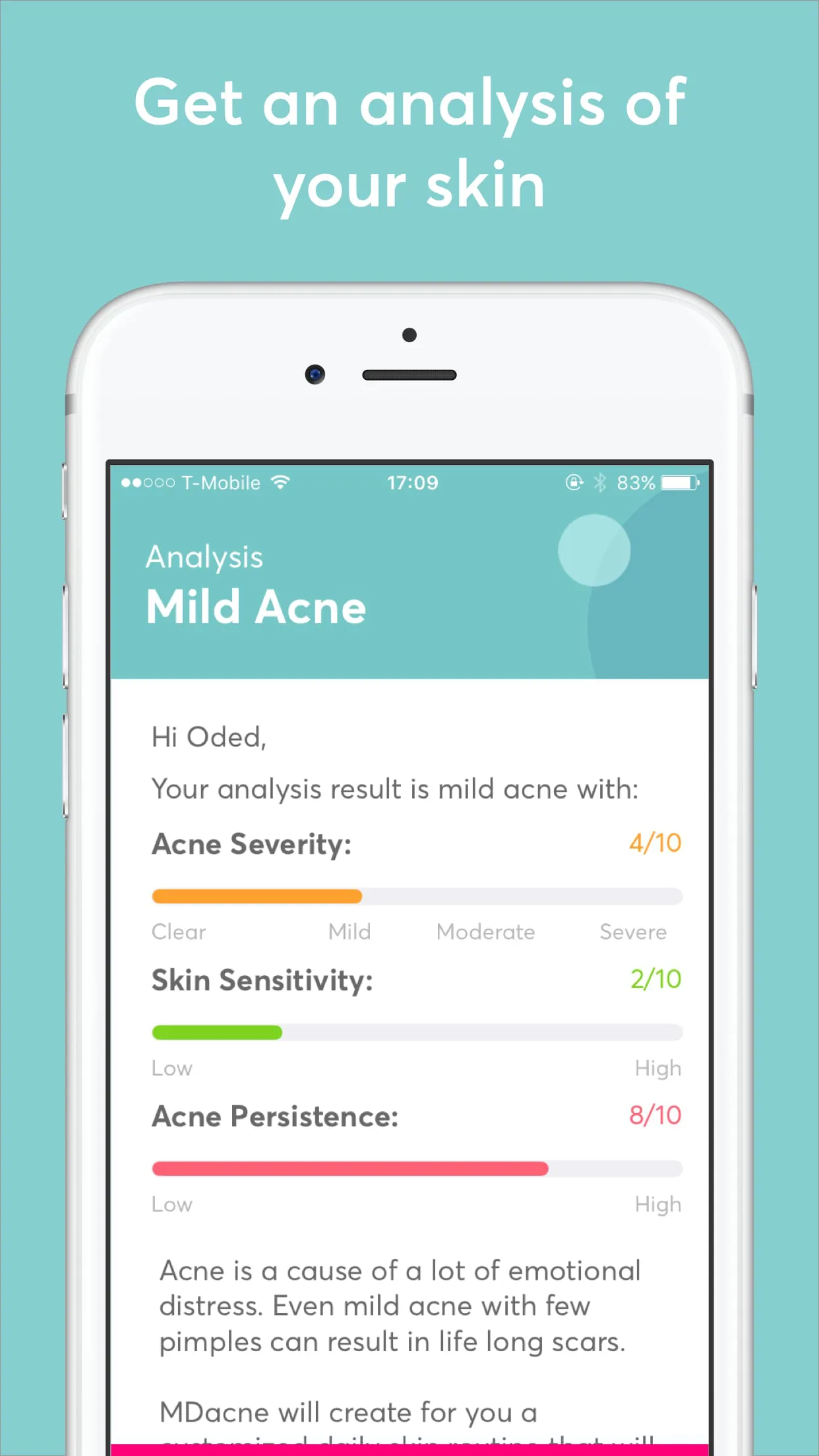 MDacne