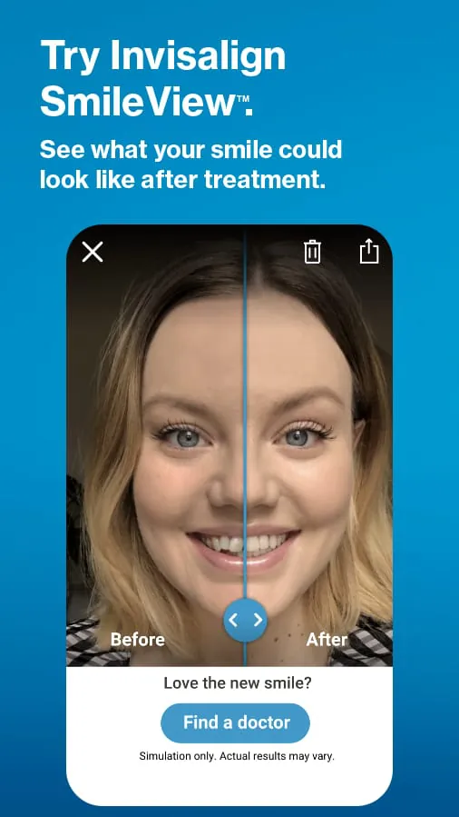 My Invisalign