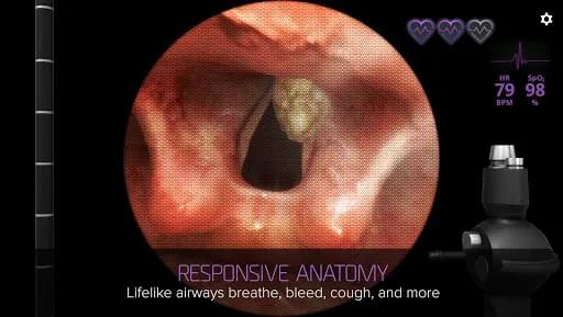 Airway Ex