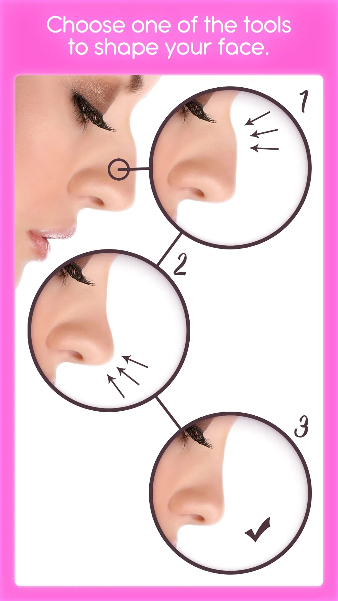 Rhinoplasty
